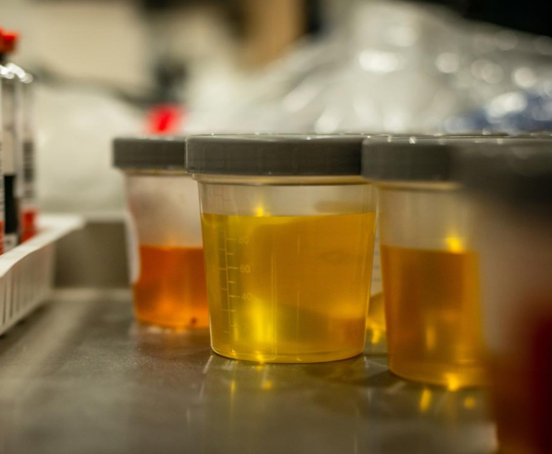 Can Synthetic Urine Really Beat Drug Tests?