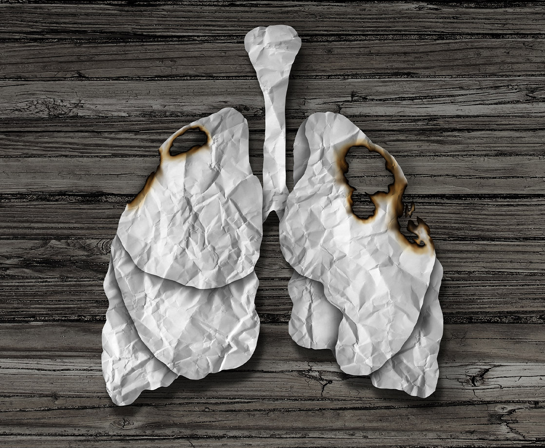 A Double Lung Transplant Saved a Vaping Illness Patient’s Life