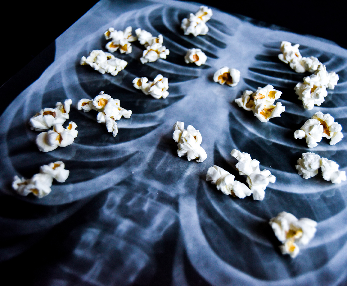 Is This the First Case of “Popcorn Lung” Caused by Vaping?