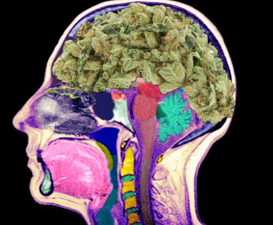 Cannabis Helps Protect HIV Patients’ Brains From Deteriorating, Study Finds