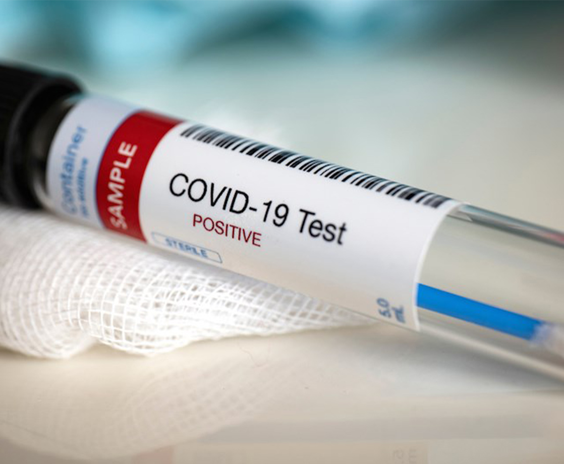 Cannabis Start-Up Develops COVID-19 Test That Can Detect Virus Within Minutes