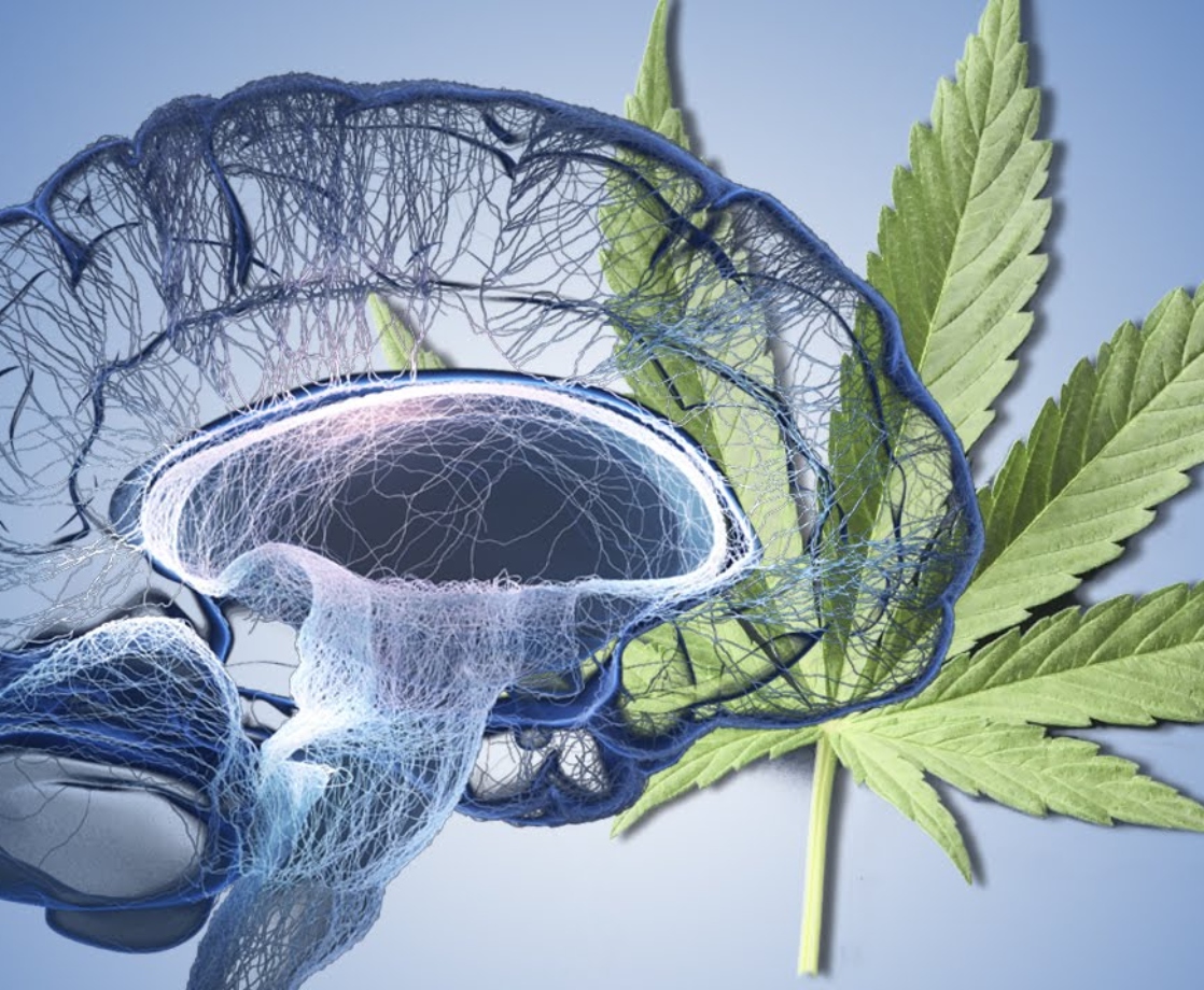 Consuming Pharmaceutical THC May Help Treat Alzheimer’s Symptoms, Study Says