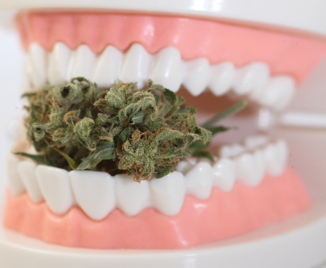 CBD and CBG Mouthwashes Are More Effective Than Traditional Oral Hygiene Products